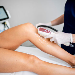 IPL hair removal at skinbox - dermal therapist carrying out hair removal on patient