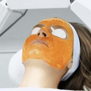 lady with kleresca gel on her face being treated for acne