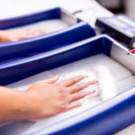 Iontophoresis-sweat-treatment-on-hands-in-trays-of-solution