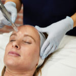 patient receiving dermal needling treatment at SkinBox