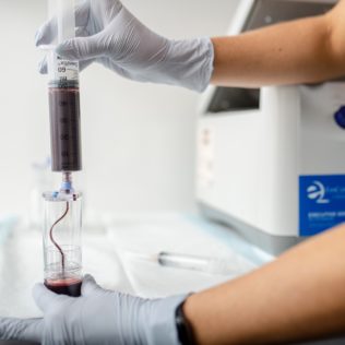 photo of blood being processed for platelet rich plasma treatment