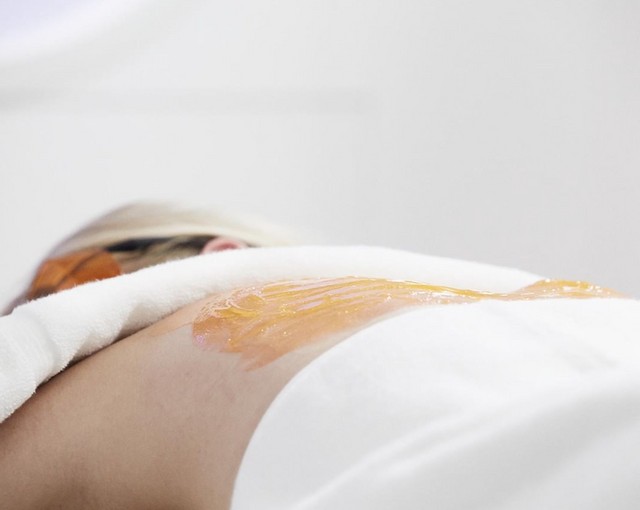 image of lady with kleresca gel on her back being treated for acne