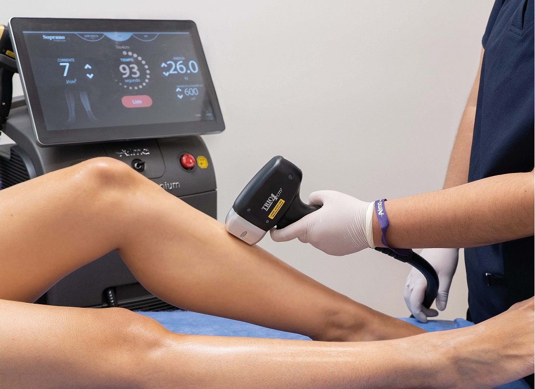 laser hair removal session on lady's leg