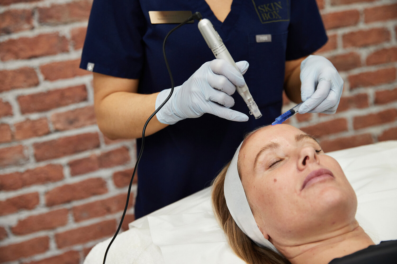 female patient undergoing dermal needling procedure to her face with blue algizome exosome serum